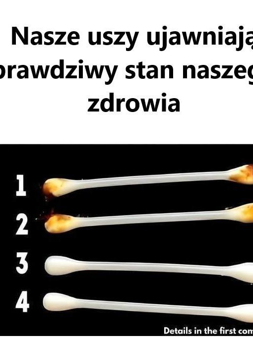 Co Uszy Mówią o Twoim Zdrowiu? Zaskakujące Fakty i Wskazówki