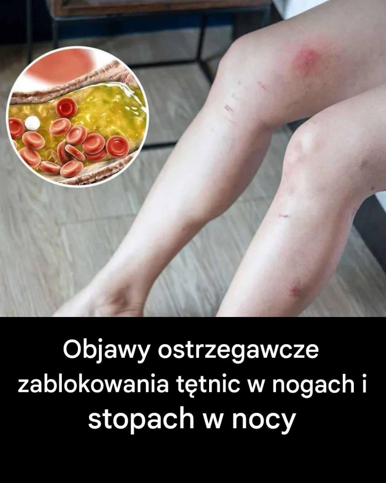 Jak Twoje stopy mogą sygnalizować problemy z sercem i zatkane tętnice